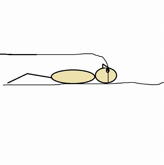 MRIに入った目線の手書きイラスト